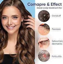 IRISTAR Dandruff Shampoo, Anti Dandruff Shampoo For Man And Woman, Itchy  Scalp Shampoo Dandruff Treatment For Folliculitis, Psoriasis And Seborrheic  Dermatitis : Buy Online at Best Price in KSA