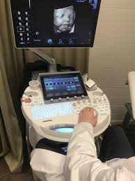 Mit dem 3d ultraschall siehst du dein kind dreidimensional. Ultraschalldiagnostik Freiburg Dr Med Klaus Keller Was Ist 3d 4d Sonographie Ultraschall