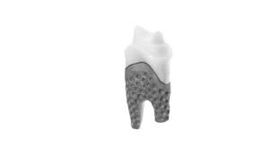 We did not find results for: Natural Dental Implants Ag Announces 3d Printed Replicate Tooth At The International Dental Show In Cologne
