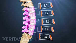 If a bone is damaged, or you have a herniated disk or pinched nerve, you may need surgery. Lower Back Pain Symptoms Diagnosis And Treatment