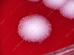 Image result for Anthrax