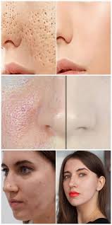 как быстро сузить поры на лице в домашних условиях Pory Na Lice Ischeznut Cherez 3 Dnya Esli Delat Vot Tak Beauty Advice Facial Skin Care Beauty Skin Care