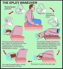 The epley maneuver, named after john epley, m.d., is a well accepted treatment for. Pin By Annalee Alviani On My Plans Vertigo Treatment Epley Maneuver Vertigo Exercises