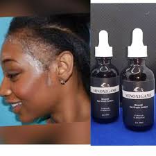 Robert Abreu (@minoxigame) · Instagram photos and Reels