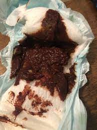 We did not find results for: Bentuk Dan Warna Najis Bayi Petunjuk Kesihatan Anak Papa Mama Wajib Ambil Tahu