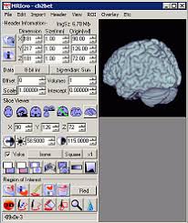How to check spm result using sms? Mricro Software Guide