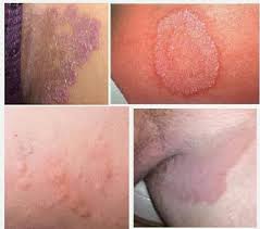 Pemilihan burung yang baik kita akan memulai dari memilih burung yang baik, yaitu, dengan memperhatikan beberapa hal berikut ini, diantaranya adalah: Penawar Berkesan Merawat Kurap Dengan Rumput Sambau Yang Ramai Tidak Tahu Kartel Dakwah