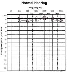 Vr4 Hearing Loss 6 Basic Hearing Evaluation