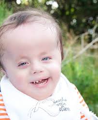 Special Needs Spotlight: Aaron » This Little Miggy