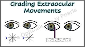 Image result for Extraocular Movement
