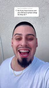 Reply to @emily970a CAN YOU GO TO PRISON WITH BRACES ON!!! #fyp #foryou  #trending #prison #teeth