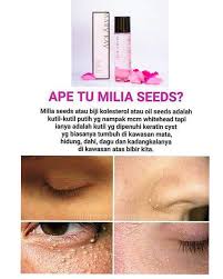 4 petua hilangkan gastrik cara semulajadi. Petua Hilangkan Biji Kolestrol Cara Hilangkan Bintik Bintik Kolestrol Bawah Mata Orang Panggil Dia Milia Seeds Ataupun Biji Kolestrol Trenx Ka