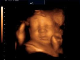 27 Weeks How To Memorize Things Ultrasound Pictures 3d Ultrasound Pictures