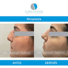 Joseph Setton's Instagram, Twitter & Facebook