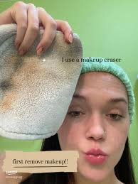 Effective Skincare Products for Your Accutane Journey