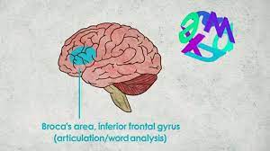 Reading is a real workout for your brain. What S Going On Inside A Dyslexic Student S Brain Kqed