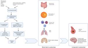 Image result for Chorioamnionitis