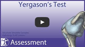 Image result for Yergason Test