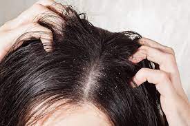 Other grease stains on a sofa might come from hair oil and beauty products. Greasy Hair Surprising Causes Behind Oily Locks Reader S Digest