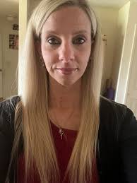 Introduction to Neurofibromatosis Support Group