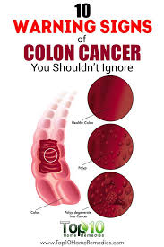 Warning signs of colon cancer and risks we've got to educate ourselves, educate our families, educate our community, and sometimes you need to educate your doctor. the death of chadwick boseman has left a lasting impact on the african american community. Colorectal Health