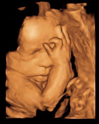 Image result for tbn:T5UajvfpShvp6M::www.photoslinks.com/index.php%3Foption%3Dcom_joomgallery%26func%3Dwatermark%26catid%3D4%26id%3D23%26Itemid%3D2