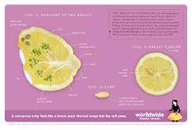 Many conditions can cause lumps in the breast, including cancer. Pin On Words I Wrote