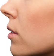 Louis, mo, our patients generally need to remain home from work for a few days post surgery. Septoplasty Beverly Hills Deviated Septum Surgery Dr John Layke