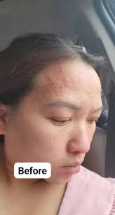 Sonya Sed Dial Soap Before and After