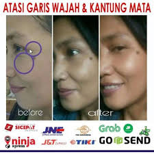 Oak ridge, new jersey3 contributions1 helpful vote. Limited Oshin Beauty Paket Acne Glow Produk Kecantikan Lainnya Perawatan Kecantikan Bukalapak Com Inkuiri Com