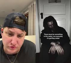 Bruises Samuel Harness