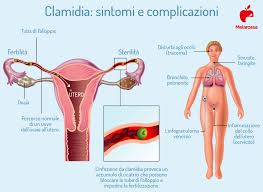 Dependiendo de dónde vivan, se habla de varios tipos de clamidia: Clamidia Che Cos E Come Si Trasmette Sintomi Cure E Prevenzione
