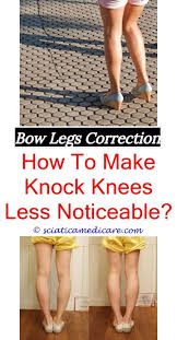 Bow Legged Women Knock Knees Bow Legged Correction Bow Legged