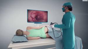 Diese zeitspanne reicht aus, da. Gastroenterologie Hepatologie Darmspiegelung Kantonsspital Baselland