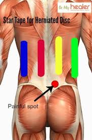 Pin On Kinesio Tape