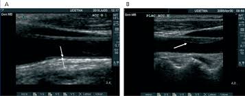 Coronary Angioplasty Test | Holter Monitor | Best Echocardiogram Test