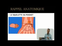 Fmpm Moocs Les Fractures De L Extremite Inferieure Du Radius Pr Youssef Najeb Youtube