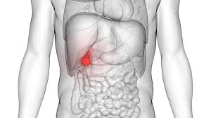 Know About Bile Leakage After Gallbladder Surgery In Usa Gallstones Gallbladder Gallbladder Surgery