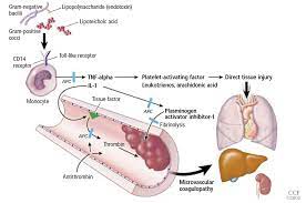 Sepsis that progresses to septic shock has a death rate as high as 50%, depending on the type of organism involved. Disease Management Sepsis