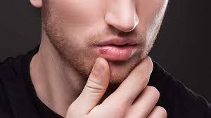 Apakah munculnya bintik merah pada bayi baru lahir setelah demam berbahaya untuk kesehatannya? Bibir Kering Pecah Pecah Dan Melepuh Akibat Terserang Virus Ada 4 Cara Mengatasinya Warta Kota