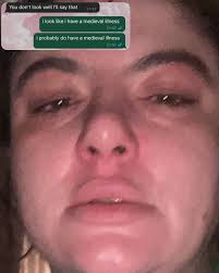 ✨ healing girl era* ✨ *got myself hair extensions instead of sectioned xxxxx