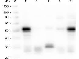 Goat serum was obtained from healthy animals of us origin and under the care of a registered application notes this conjugate is suitable for western blot, elisa and immunohistochemistry. Goat Anti Rabbit Igg Heavy Light Chain Antibody Hrp Abin101990