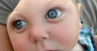 Phát hiện trẻ sơ sinh VN bị chứng đầu nhỏ nghi do Zika