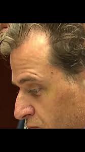 Chattanooga Tennessee Doctor Swinging