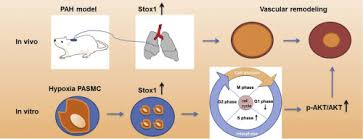 Learn vocabulary, terms and more with flashcards, games and other study tools. Stox1 Induced The Proliferation And Cell Cycle Arrest In Pulmonary Artery Smooth Muscle Cells Via Akt Signaling Pathway Sciencedirect
