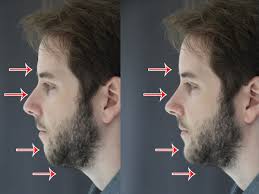 One common issue for 75% of americans over the age of 60 is. I Let A Doctor In The Plastic Surgery Capital Of The World Suggest How I Should Change My Face And He Came Up With 30 000 Of Surgeries Business Insider India