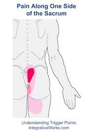 Pin On Low Back Trigger Point Pain