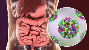 Mar 05, 2021 · norovirus is a very contagious virus that causes vomiting and diarrhea. Norovirus Symptome Behandlung Und Verlauf Focus Arztsuche