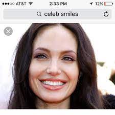 You would like your smile to look wider and you can do this with either bonding which allows you to keep your natural teeth and make them larger and change their shaped to look more aesthetically pleasing. How To Change The Way My Smile Looks Photos
