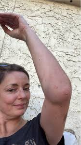 Lost the balance 😱 nothing broken, just bruises and concussion...